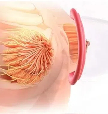 Breast Enlargement Pump: How to Use It for the Best Results